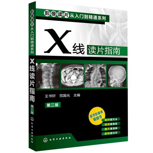 X线读片指南(第二版) 商品图0