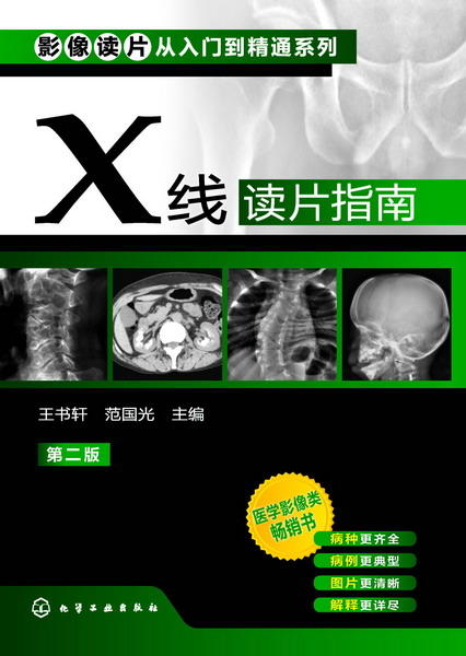 X线读片指南(第二版) 商品图1