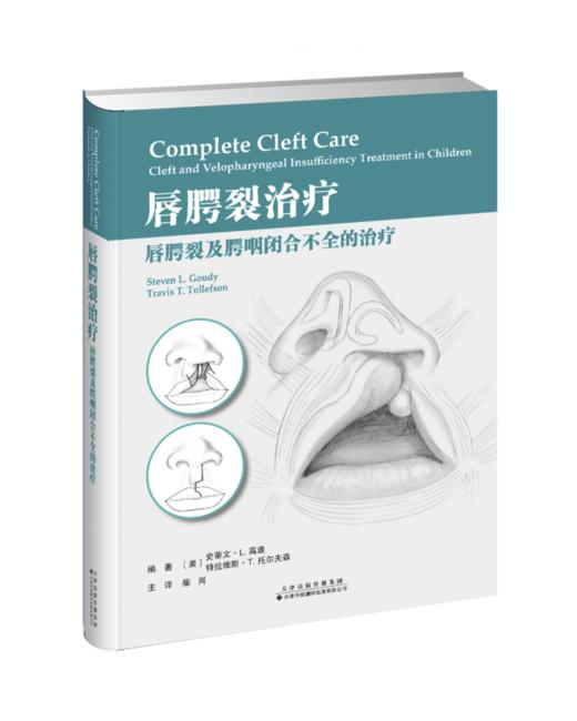 唇腭裂treatment——唇腭裂及腭咽闭合不全的treatment 商品图0