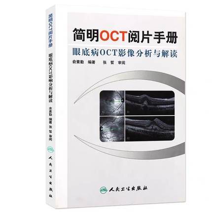 简明OCT阅片手册 商品图0