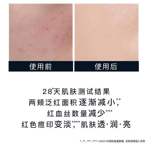 澳洲Cemoy神金水150ml 商品图8