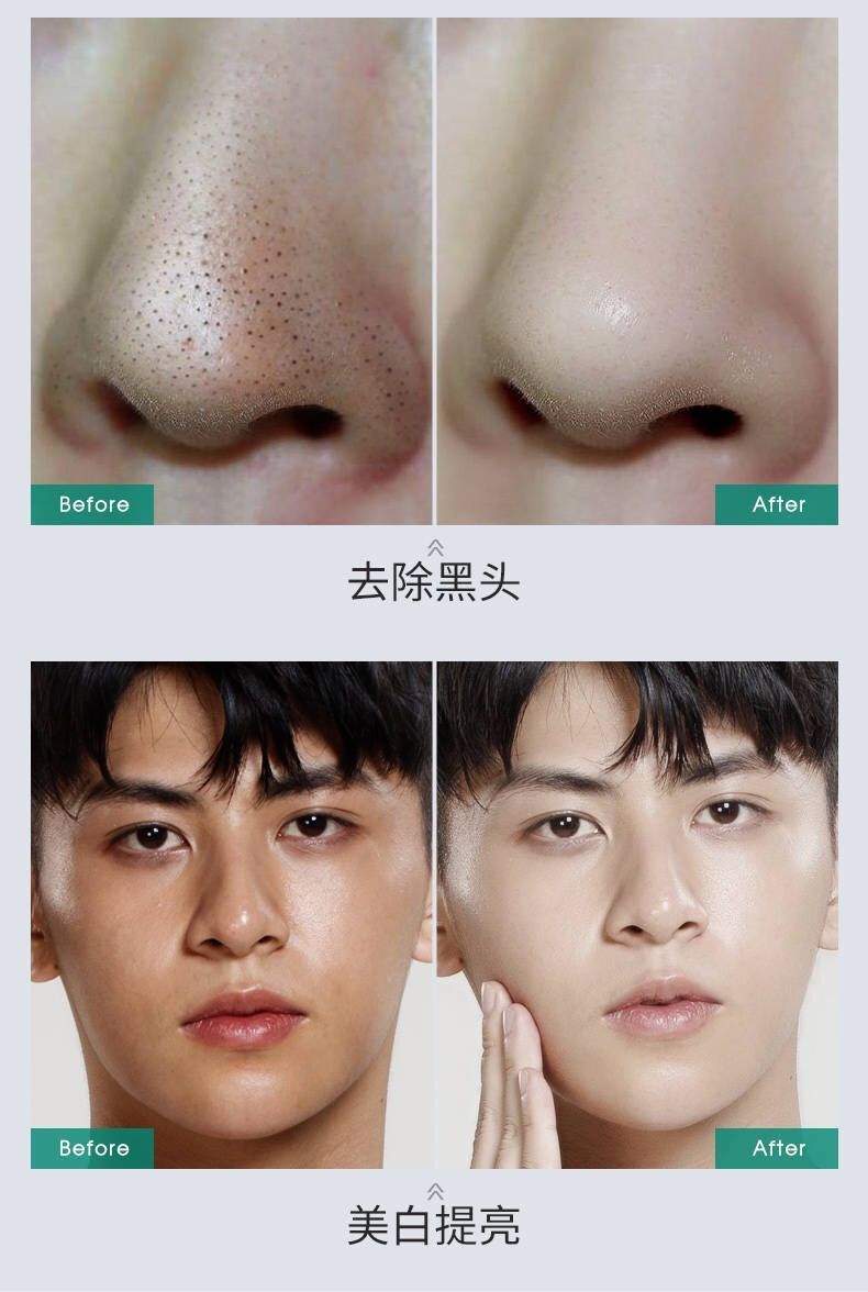 洗面奶男士祛痘控油清爽去黑头螨虫青春期美白补水保湿洗面奶