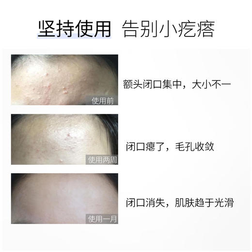 【双12大促】嘉媚乐马鞭草酮迷迭香薰衣草复合纯露  去闭口控油保湿 收细肌肤  深层补水喷雾 商品图3