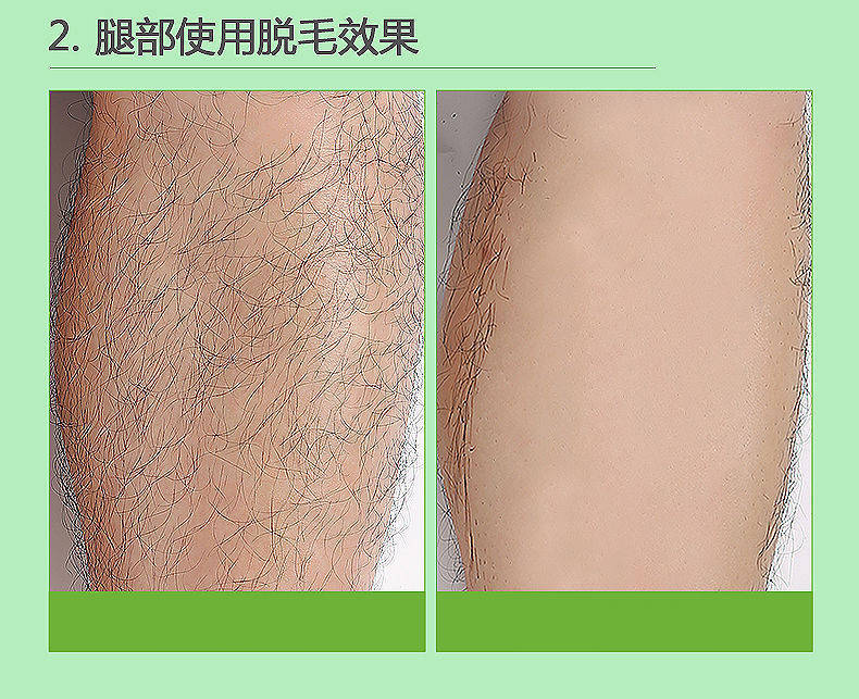 芙迪脱毛膏男女学生半永久全身去腋下腋毛腿毛喷雾除毛去毛神器根