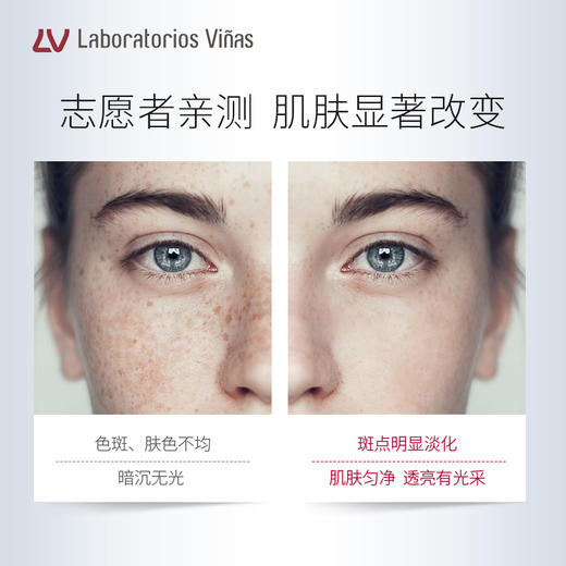 西班牙Vinas月光液四氢姜黄素美白淡斑精华30ML/瓶  A-2093 商品图3