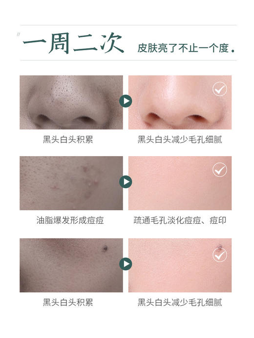 【在家也能做清洁SPA】一周两次 让你皮肤白一个度 疏通毛孔 排除残留  让你皮肤干干净净 素萃面部深层清洁毛孔脏东西焕颜清洁霜 商品图2