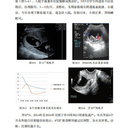 宫颈机能不全防治 商品图3