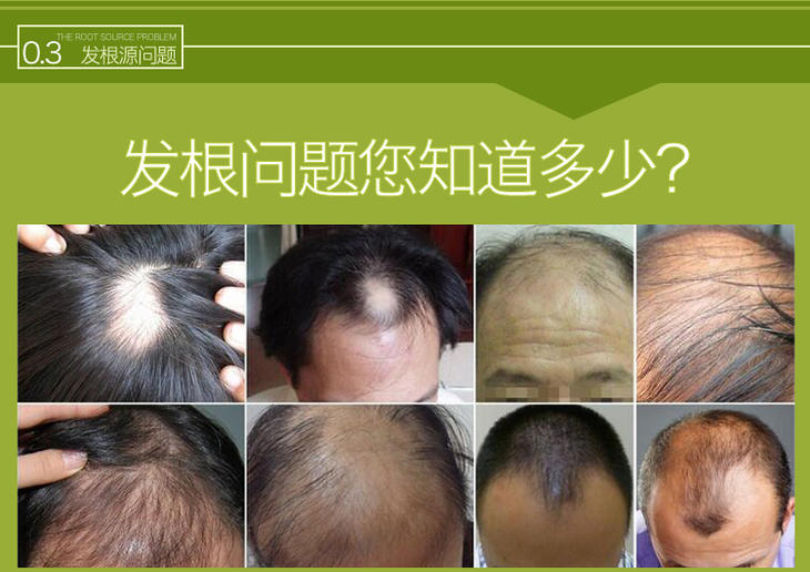 域发营养活力润发乳230ml(批次20210920/20210614随机发)