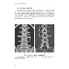 容易漏、误诊骨折影像学及图谱 商品缩略图1