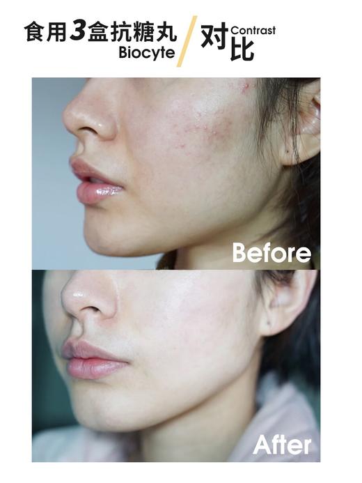 法国Biocyte抗糖丸6代金砖k糖丸q黄淡纹抵御糖化30粒（更新包装） 商品图2