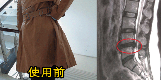 腰间盘突出动.gif