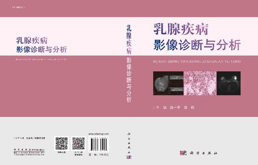 乳腺疾病影像诊断与分析 商品图3