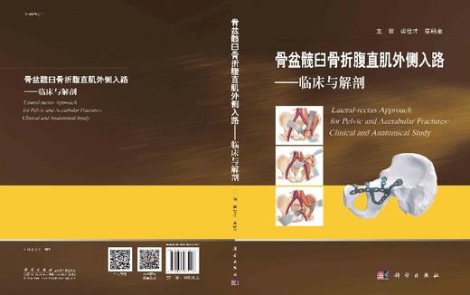 骨盆髋臼骨折腹直肌外侧入路——临床与解剖 商品图3