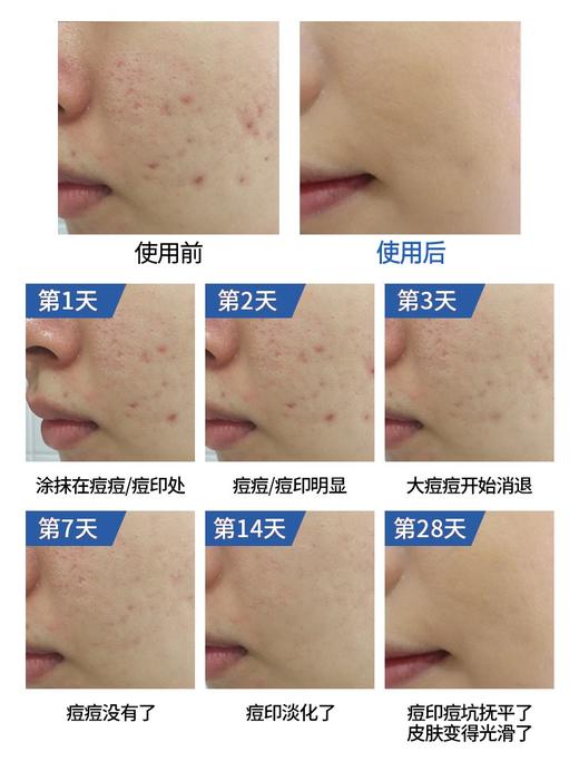 MG产 法文外包装 芭克bahen zengsheng 修复凝胶 15克 商品图4