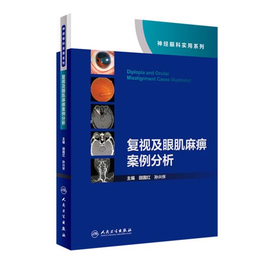 复视及眼肌麻痹案例分析（神经眼科实用系列） 商品图0