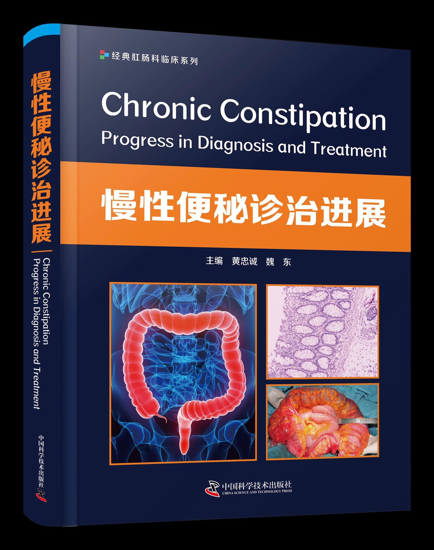 慢性便mi诊治进展 黄忠诚 魏东数主编 数十余位专家联袂编著