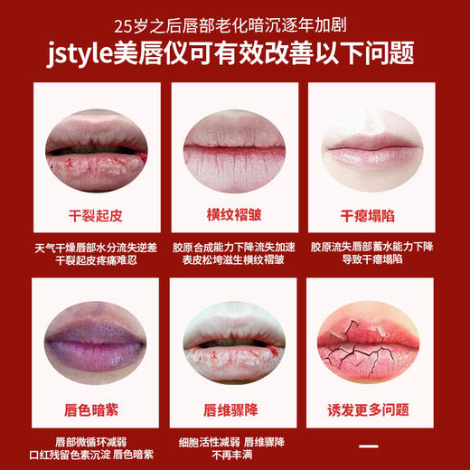 【美唇仪】J-STYLE阿玛尼同款色调水光抗皱美唇仪，激活胶原蛋白再生，恢复唇部水润 商品图2