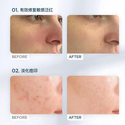 【孕妇可用】澳洲 CEMOY澳诗茉 白金流明神经酰胺精华水 神金水 150g 商品图8