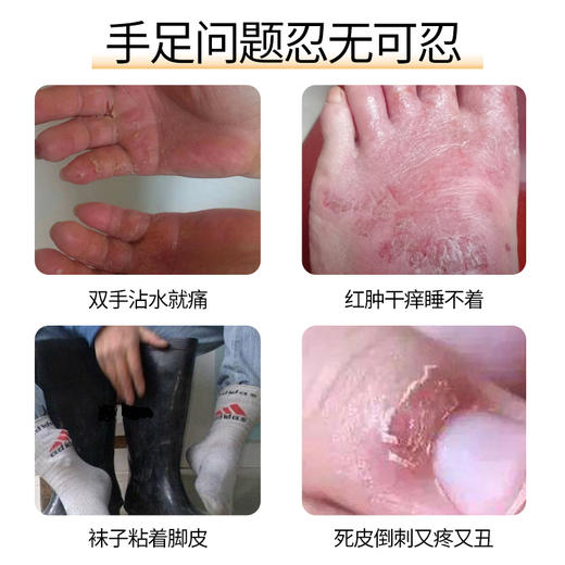 【买2送1 】人参皲裂修护油草本精华 锁水保湿 深层渗透 快速吸收 远离干裂  孕妇小孩都能用 商品图6