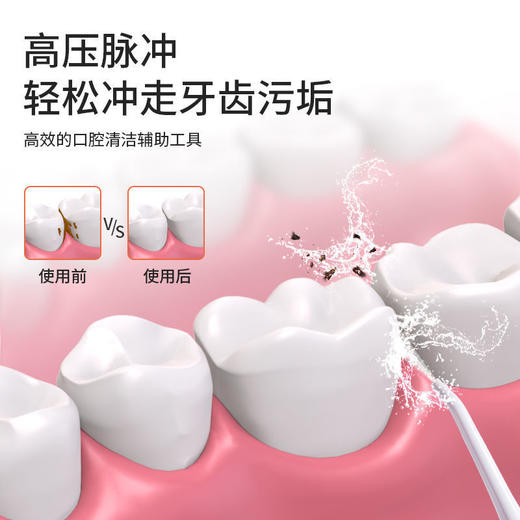 雅玺V18冲牙器便携式家用电动水牙线洗牙菌斑神器口腔清洁牙结石 商品图3