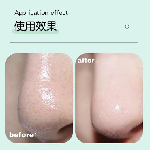 韩国 CNP 鼻贴膜套装 10组/盒 商品图5