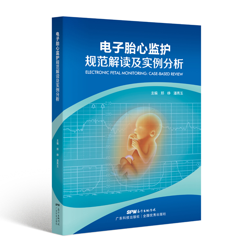 电子胎心监护规范解读及实例分析