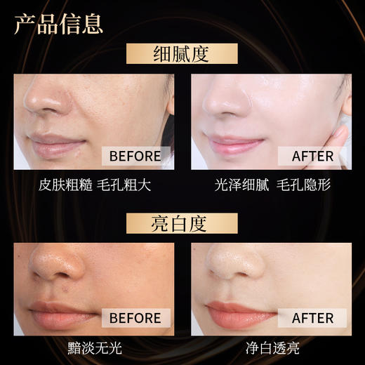 奢宠玫瑰赋活黑金面膜（27ml*5片/盒） 商品图2