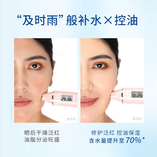 【拍一发三】ZLCA-雪绒花冰感修护水凝露180g 商品图1