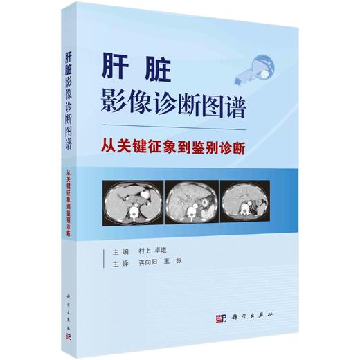 肝脏影像诊断图谱——从关键征象到鉴别诊断 商品图0