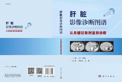 肝脏影像诊断图谱——从关键征象到鉴别诊断 商品图3