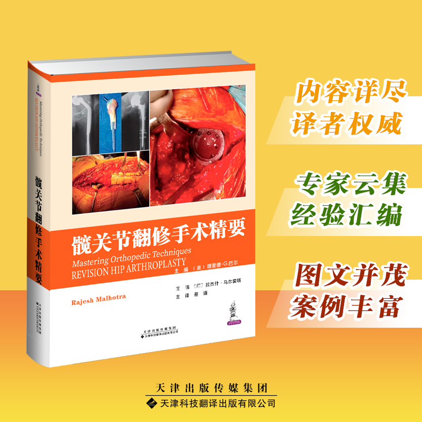 髋关节翻修手术精要
