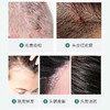 【买3发5】三椒除螨洗发皂植物精粹成分深层清洁滋养头皮100g/盒 商品缩略图1