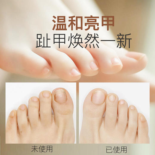 匹奇磨脚神器脚部多功能修足去死皮老茧女电动修脚器修甲指甲家用磨脚器 商品图4