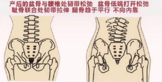 为什么一定要做产后盆骨修复 商品图0