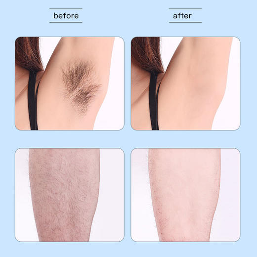 英国Dimples杜碧丝柔滑脱毛膏泡沫喷雾200ml 商品图4