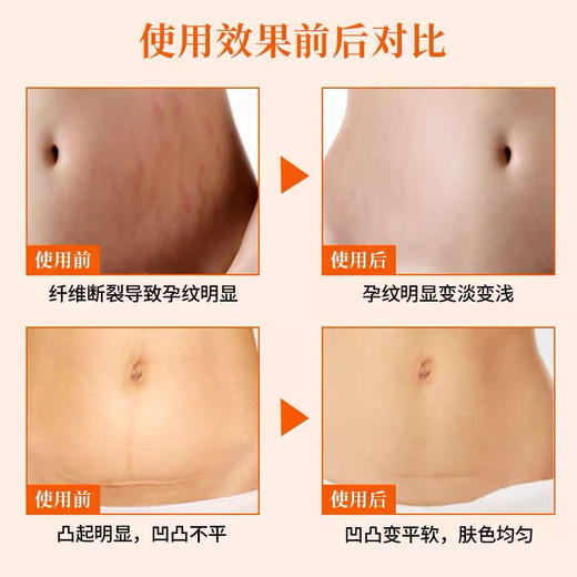 【孕妇可用】德国 BioOil百洛 淡纹抚纹紧致修复身体精华油 200ml 商品图12