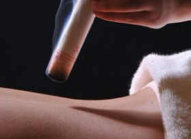  春天养生怎能不灸背，开春灸背效果佳，胜吃补药！ 