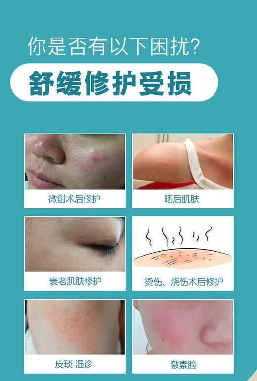 复因医用冷敷护理贴 （冷敷修复型） 商品图4