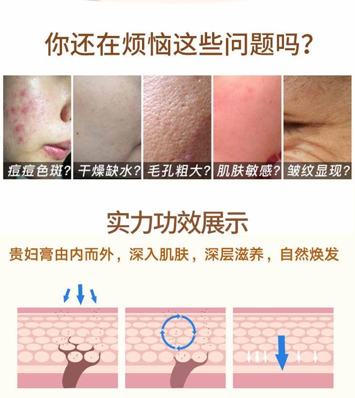 贵妇膏第二版详情页_02.jpg