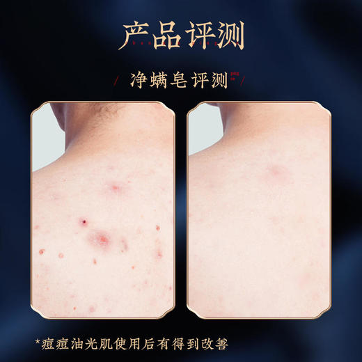 【青丝&雪肤古皂套装】“苦参皂团”，古方滋养~净肤皂2块+洗发皂2块，一盒解决洗护问题甄选进口原料，品质有保障针对不同部位，精选配料，分区细致呵护~ 商品图4