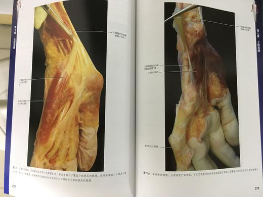 筋膜学习必读--《人体筋膜系统功能解剖》，内有大量的案例参考 商品图2