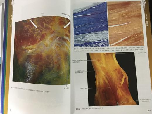 筋膜学习必读--《人体筋膜系统功能解剖》，内有大量的案例参考 商品图3