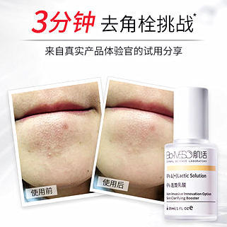 【华熙肌活】左旋乳酸肌底液去闭口神器收缩毛孔闭口粉刺毛周角化我们是30ML！！！ 商品图1