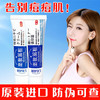 香港乐敦祛痘膏草本男女士青春痘学生粉刺祛印霜淡化痘印修复神器 商品缩略图0