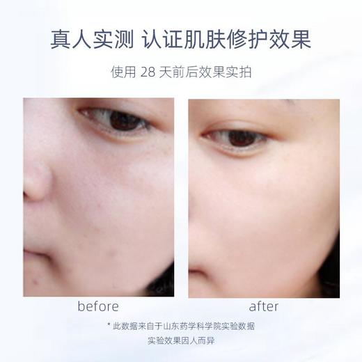 【福瑞达】Dr.Alva瑷尔博士玻尿酸前导精华液补水保湿收缩毛孔原液3%二裂酵母熬夜修护必备小黄管 商品图3