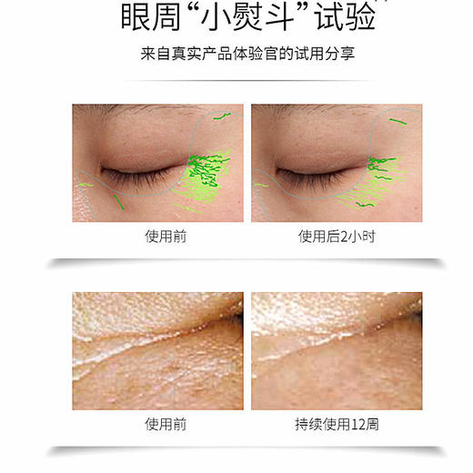 【华熙肌活】提拉紧塑眼周小熨斗GABA氨基丁酸肌底液精华原液提拉紧致改善细纹面眼部可用我们是30ML！！！ 商品图2