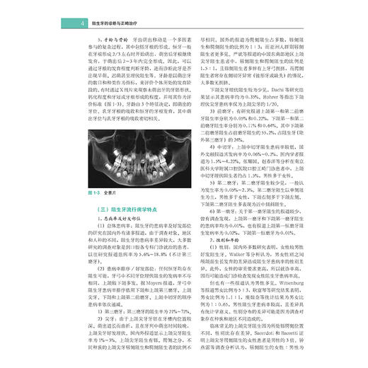 阻生牙的诊断与正畸zhi疗 商品图2
