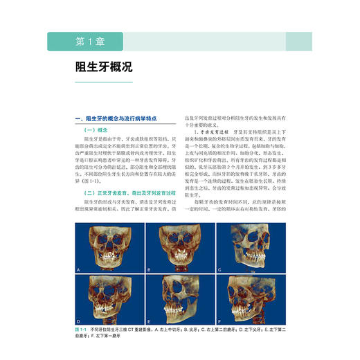 阻生牙的诊断与正畸zhi疗 商品图5