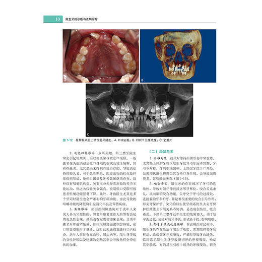 阻生牙的诊断与正畸zhi疗 商品图7
