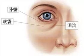 一有眼袋老十岁！这5个穴位帮你消除眼袋、黑眼圈，快学起来！ 